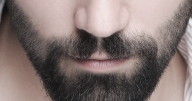 Kreisrunder Haarausfall im Bart